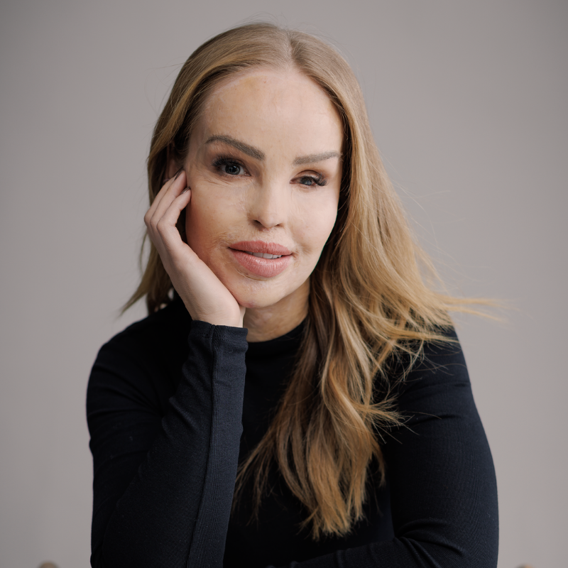Katie Piper
